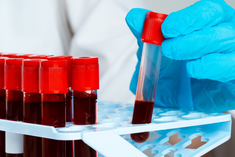Blood Tests | Blood Tests Near Me | Importance of Blood Tests | A Comprehensive Guide Blood Tests Blood Tests Near Me Importance of Blood Tests, onehealthassist.com