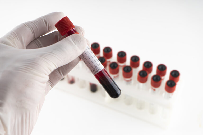 Online Blood Test in Delhi NCR | Blood Test Near Me | Blood Test Online Blood Test in Delhi NCR, Blood Test Near Me, Blood Test, onehealthassist.com