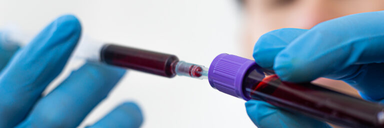 Parameters - Aarogyam 24x7 (Non Fasting) Health Checkup Package, onehealthassist.com