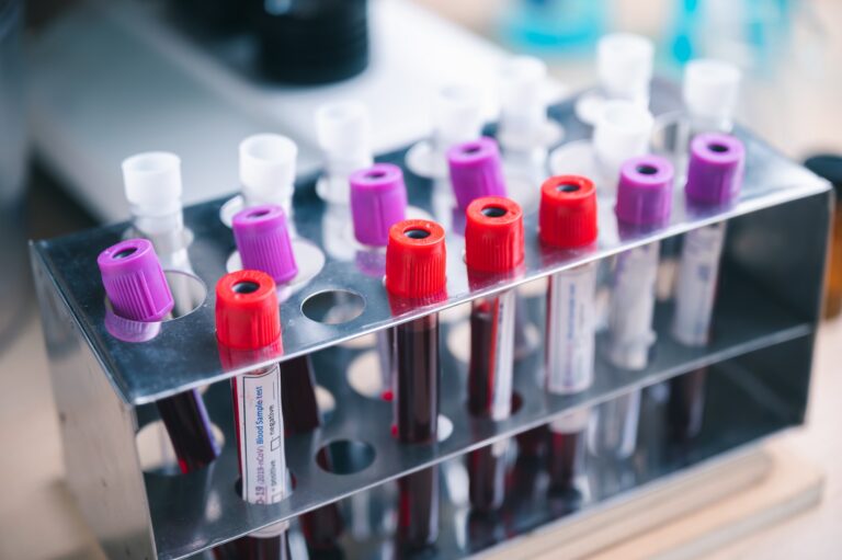 Complete-Blood-Count-CBC-Test-Home-Sample-Collection-One-Health-Assist