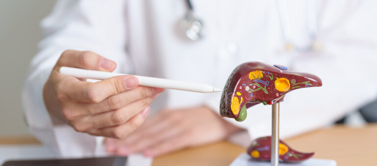 Fatty Liver (Hepatic Steatosis), One Heealth Assist