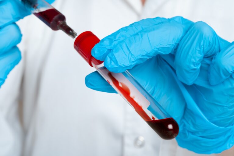Home-Sample-Collection-A-Game-Changer-in-Healthcare-One-Health-Assist