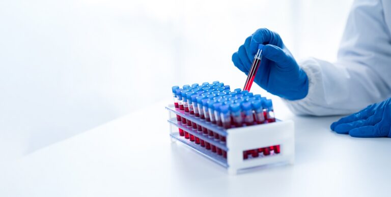 ab-Tests-at-Home-Health-Checkup-Packages-Home-Sample-Collection-One-Health-Assist
