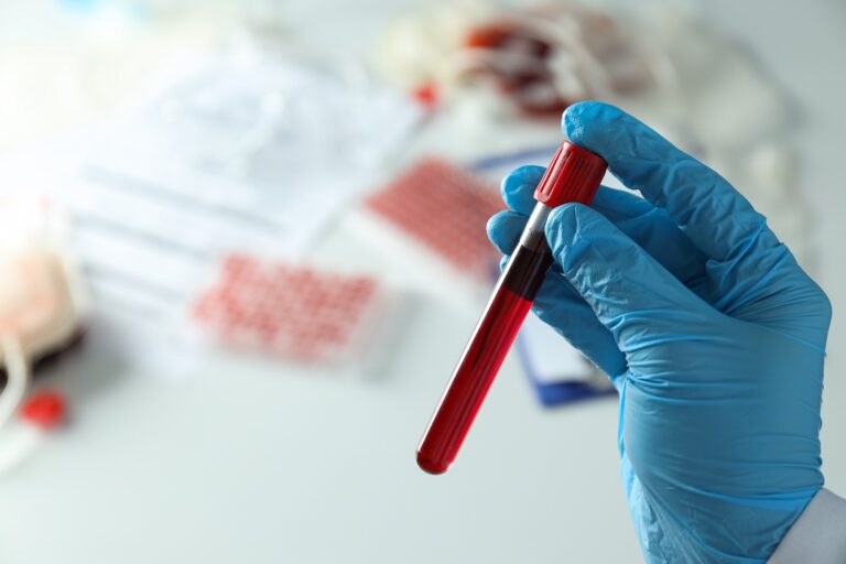 Complete Blood Count (CBC) Test Near Me | Complete Blood Count (CBC) At Home CBC Test, Complete Blood Count (CBC) Test Near Me Complete Blood Count (CBC) At Home, onehealthassist.com online health checkup and blood test booking platform.