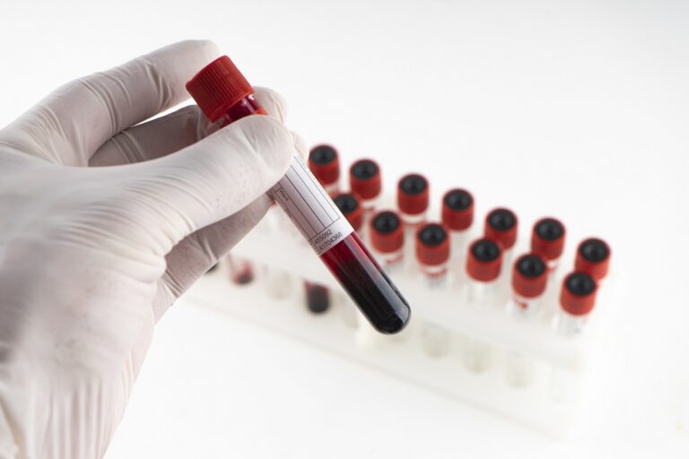 Eosinophil Count Blood Test Details, Purpose, Preparation, FAQs, onehealthassist.com