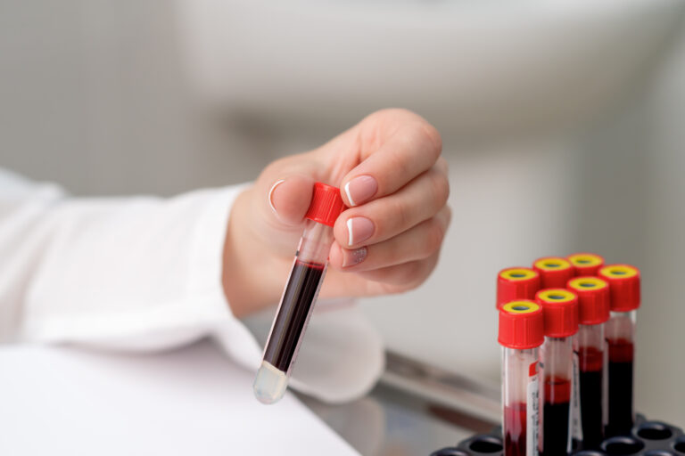 10 Essential Tips for Accurate Blood Test Results 10 Essential Tips for Accurate Blood Test Results