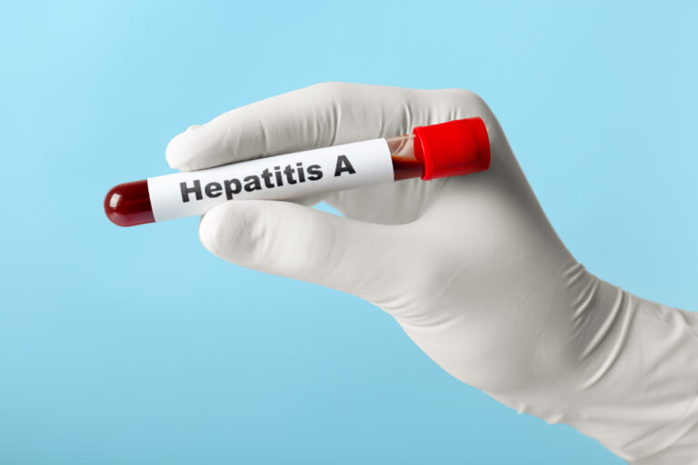 Hepatitis A During Monsoon: Symptoms, Diagnosis, Prevention & Home Test Booking Hepatitis A During Monsoon Symptoms, Diagnosis, Prevention & Home Test Booking
